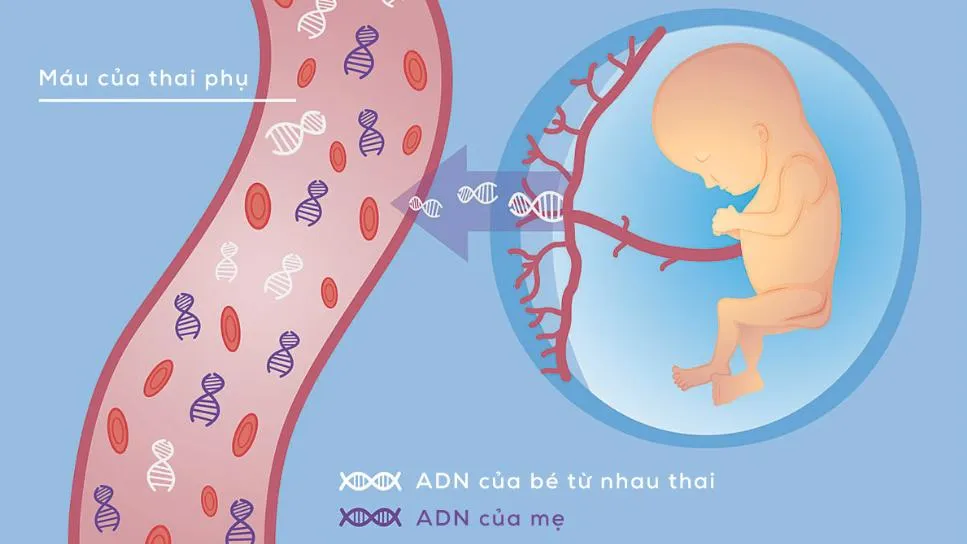 Xét nghiệm TriSure và những điều bạn cần biết