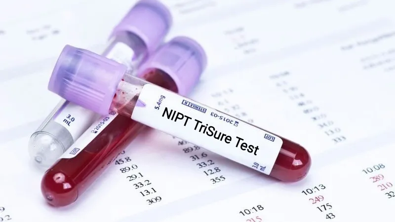 Xét nghiệm TriSure và những điều bạn cần biết