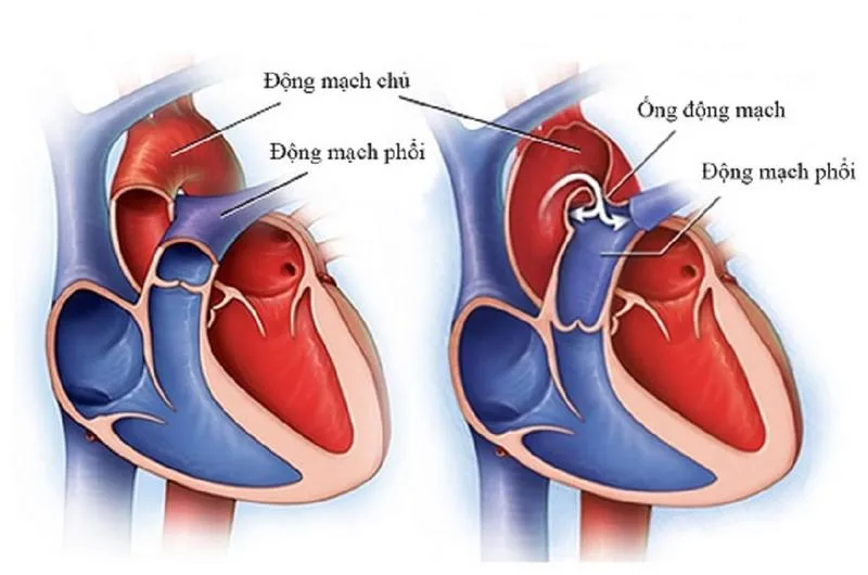 Động mạch là gì? Động mạch có cấu tạo và chức năng như thế nào?