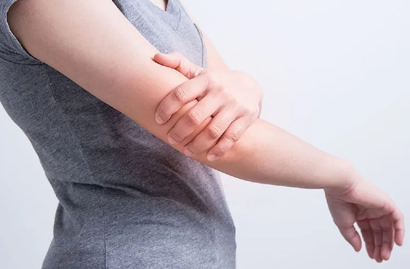 Hội chứng đau cục bộ phức tạp (CRPS): Nguyên nhân và dấu hiệu nhận biết bệnh