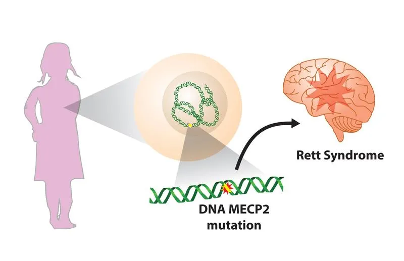 Hội chứng Rett là gì? Nguyên nhân, triệu chứng, cách chữa trị