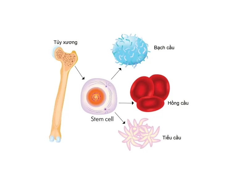 Hội chứng rối loạn sinh tủy (MDS): Nguyên nhân, triệu chứng và cách điều trị