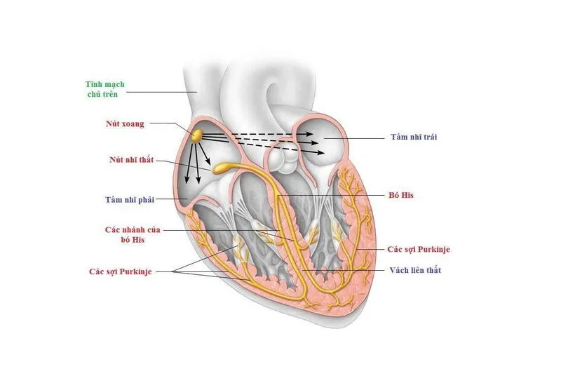 Hội chứng suy nút xoang: Nguyên nhân, triệu chứng, cách điều trị