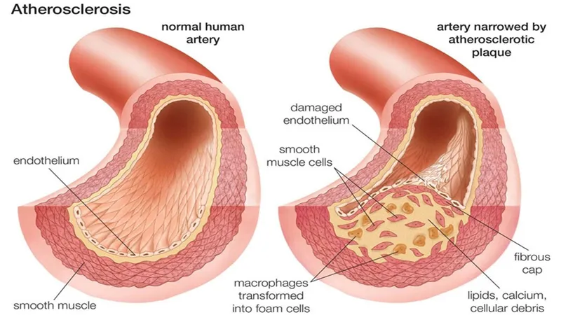 Những bệnh lý tại động mạch thận gây nguy hiểm không nên chủ quan