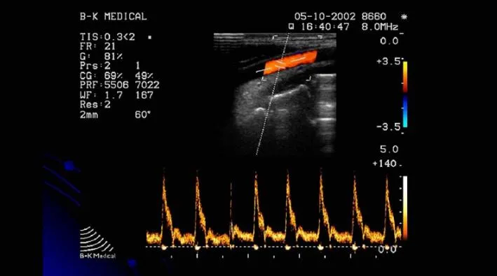 Siêu âm Doppler màu là gì? Được ứng dụng trong các trường hợp nào?