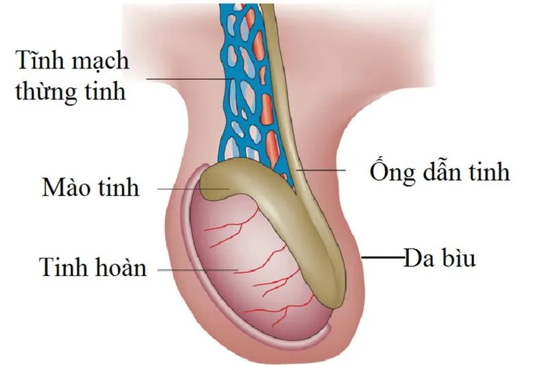 U nang mào tinh hoàn có gây vô sinh không?