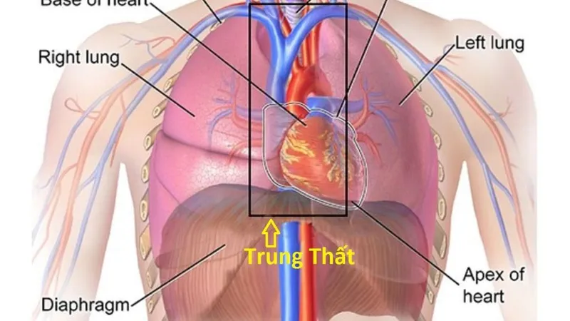 U trung thất có nguy hiểm không? Biểu hiện lâm sàng và cận lâm sàng chẩn đoán u trung thất