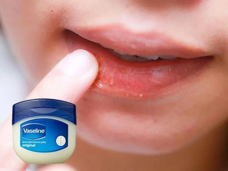 Vaseline dưỡng môi là gì? Vaseline dưỡng môi loại nào tốt nhất?