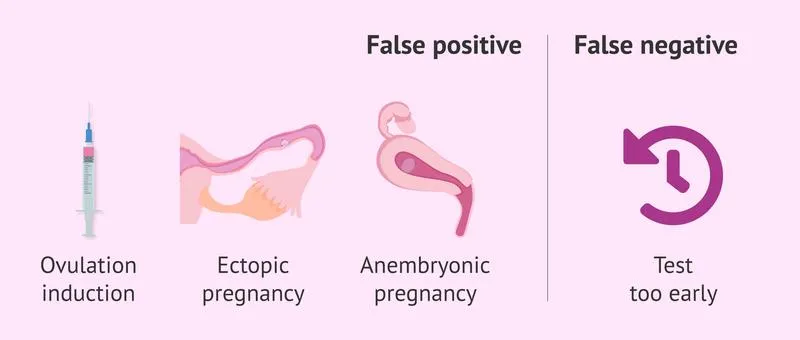 Vì sao xét nghiệm beta HCG âm tính nhưng vẫn có thai?