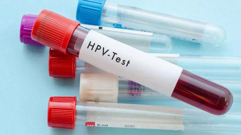 Xét nghiệm HPV là gì? Chi phí bao nhiêu?