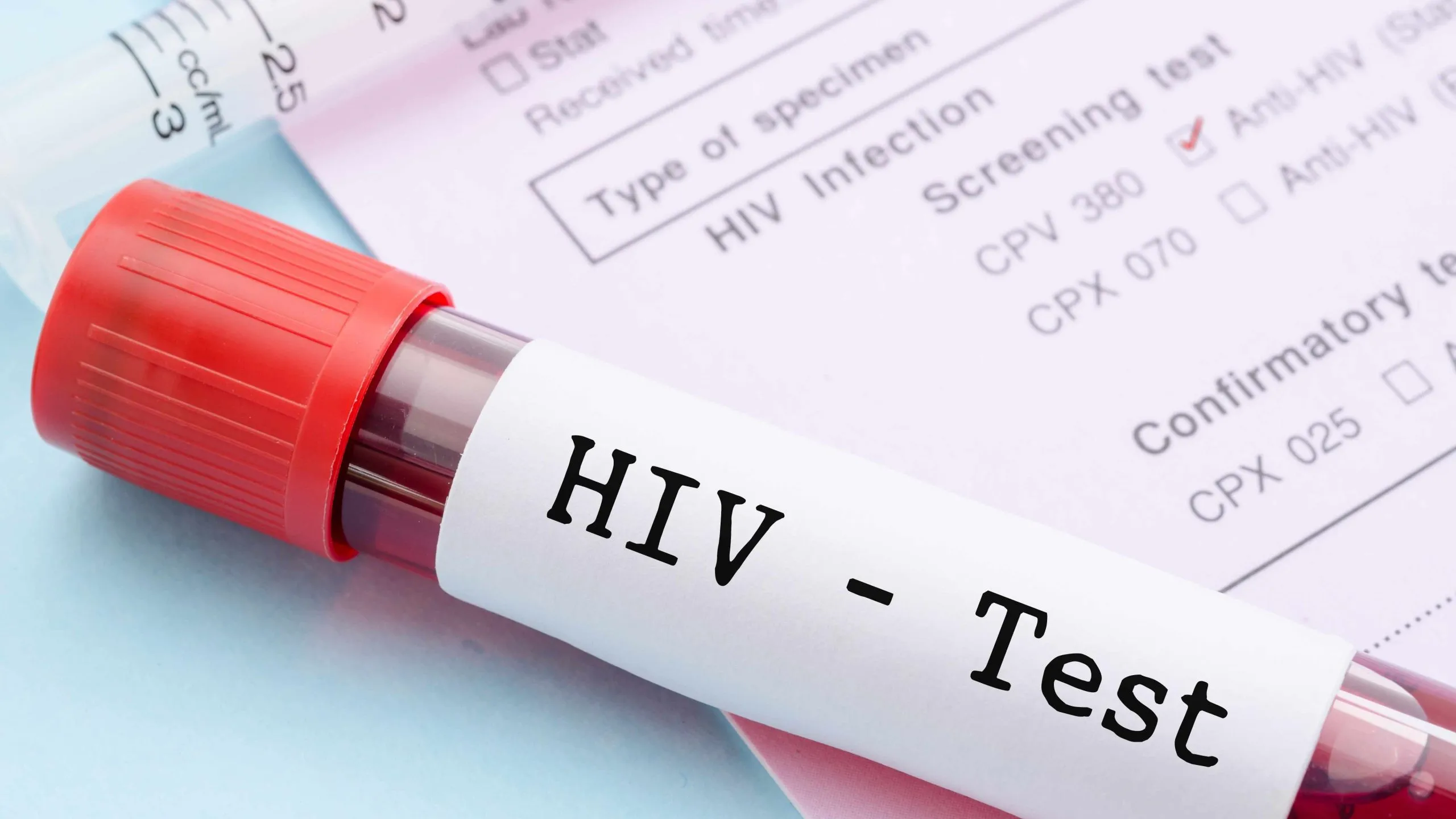 Cách đọc kết quả xét nghiệm HIV cực dễ dàng và chính xác