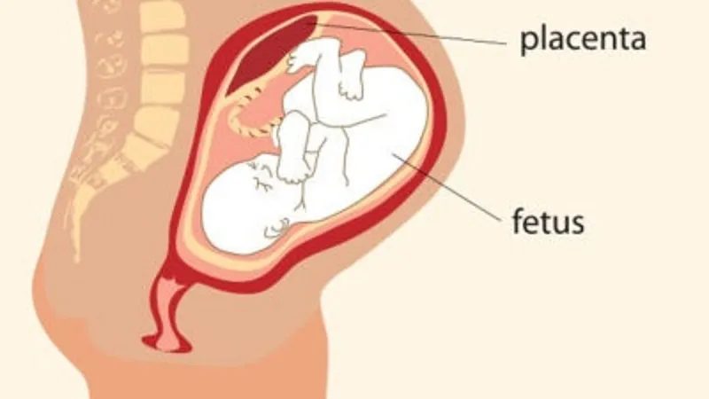 Cảnh báo hiện tượng bong nhau non 3 tháng đầu cho mẹ bầu!