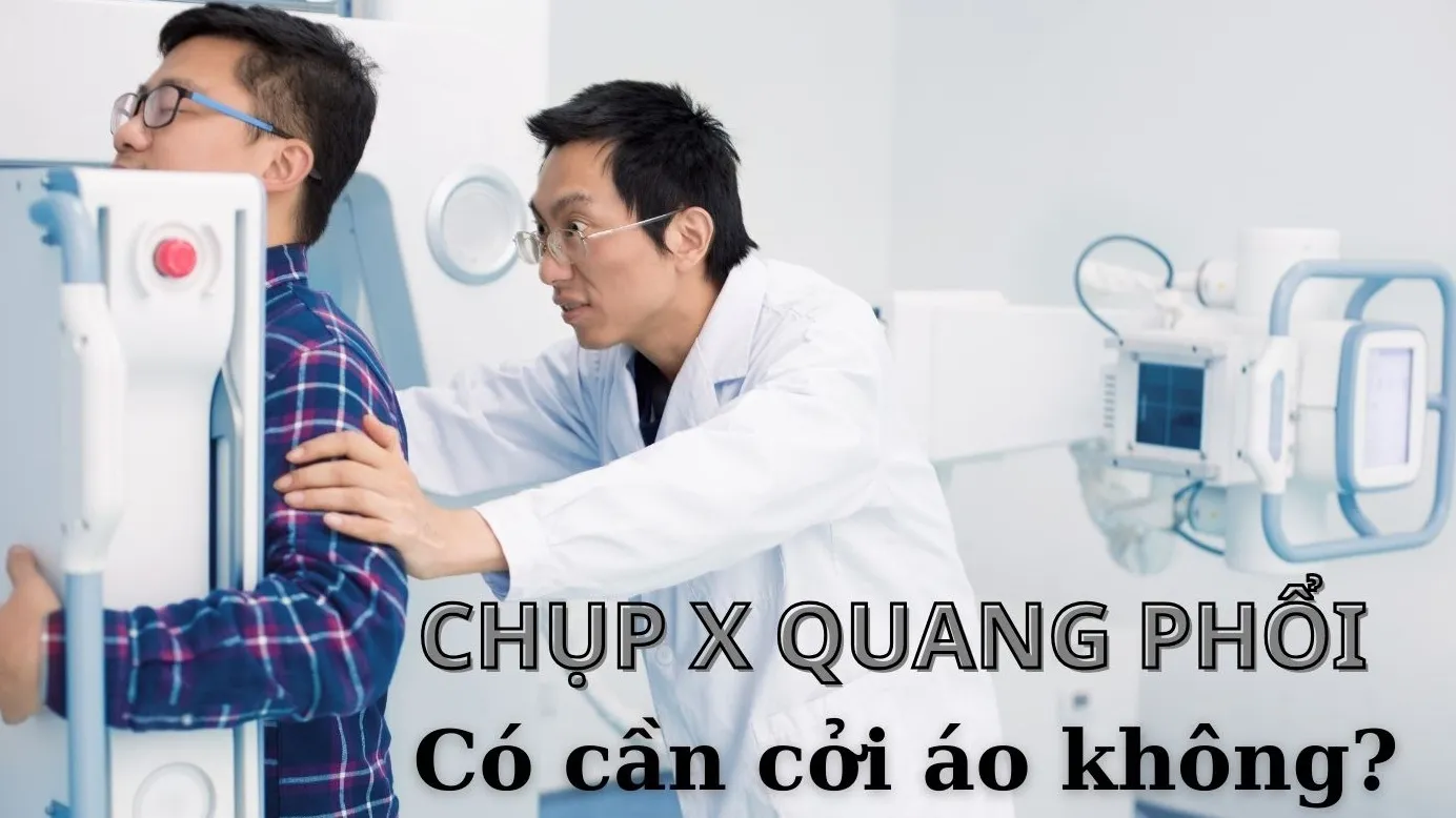 Chụp X quang phổi có cần cởi áo không?