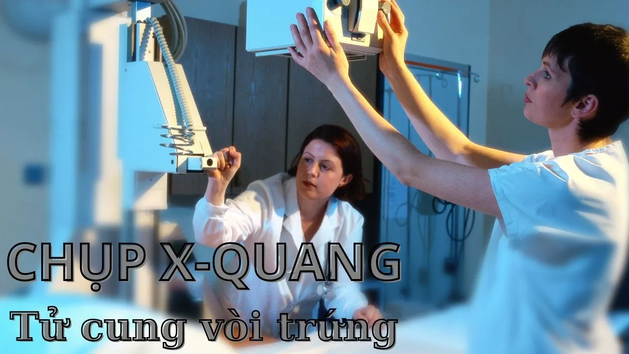 Chụp X quang tử cung vòi trứng có đau không?