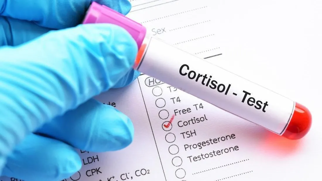 Cortisol là gì? Giá trị bình thường của nồng độ cortisol trong máu?