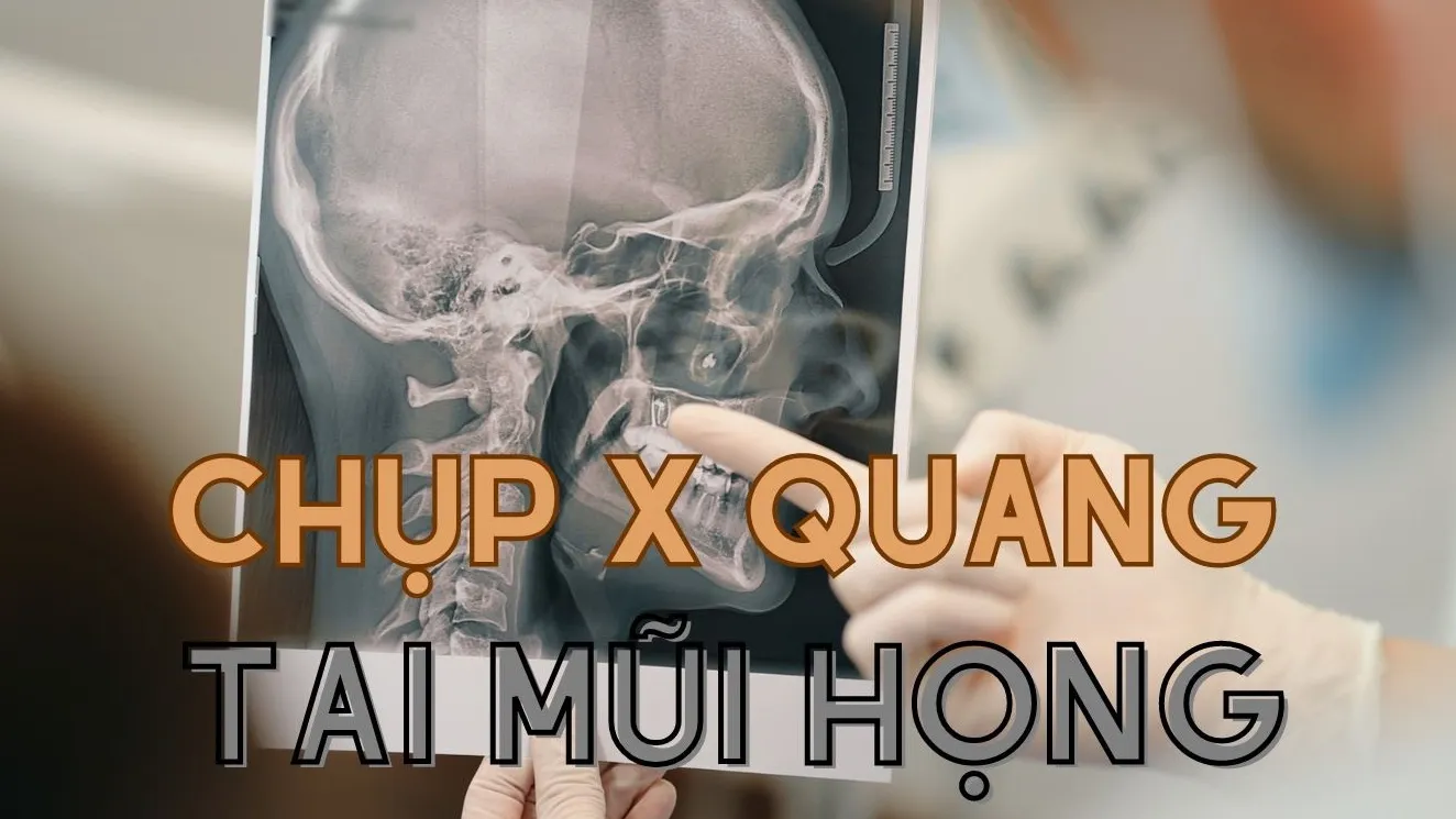 Giúp bạn hiểu rõ hơn về kỹ thuật chụp X quang tai mũi họng