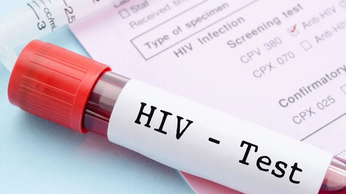 Hiểu rõ các phương pháp xét nghiệm HIV: Kiến thức quan trọng về sức khỏe cần nắm!