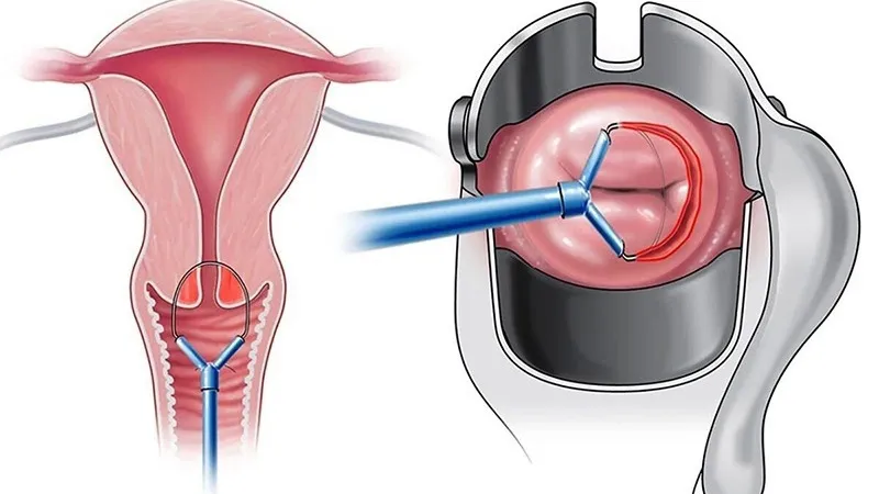 Hướng dẫn cách đọc kết quả sinh thiết cổ tử cung chính xác