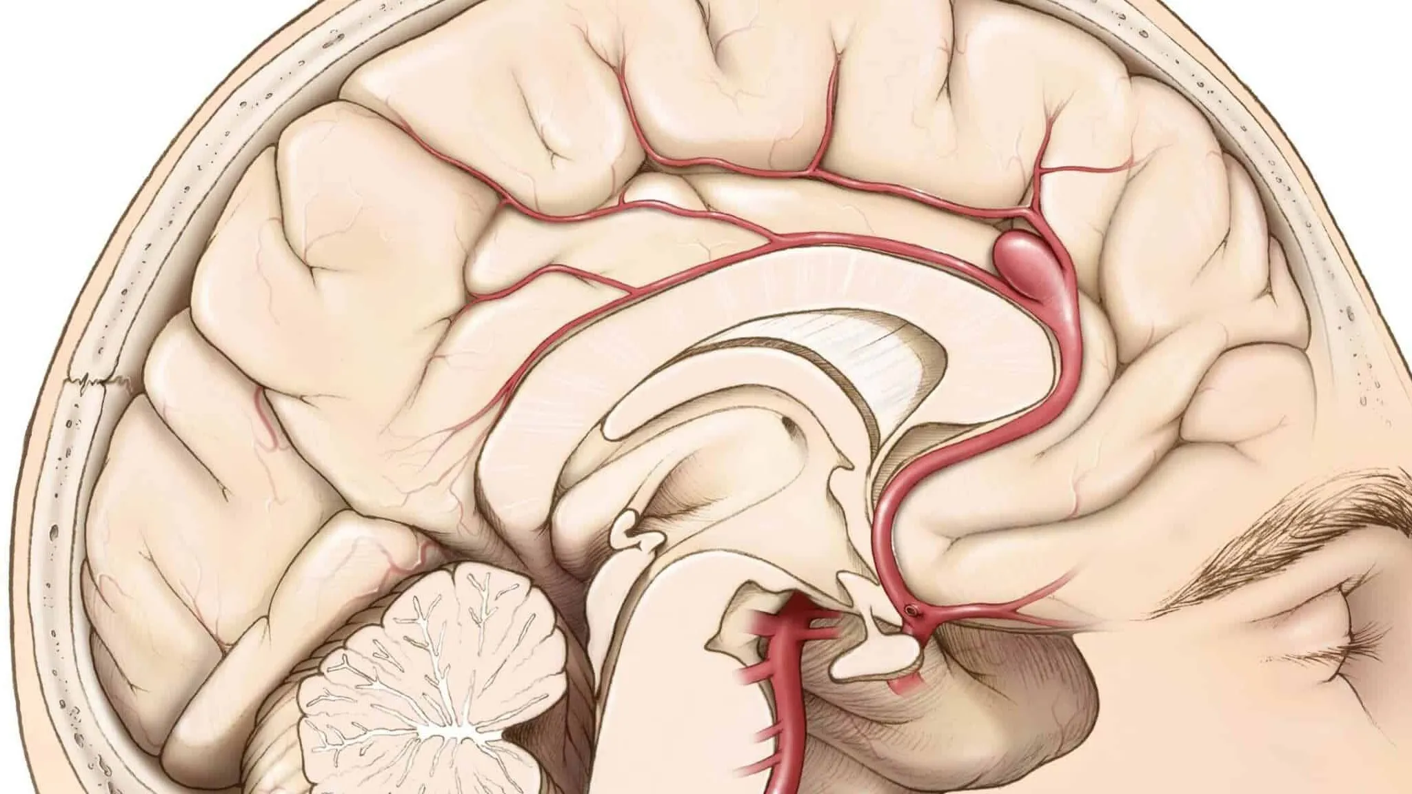 Phình mạch máu não có phải mổ không? Các phương pháp điều trị bệnh mà bạn nên biết