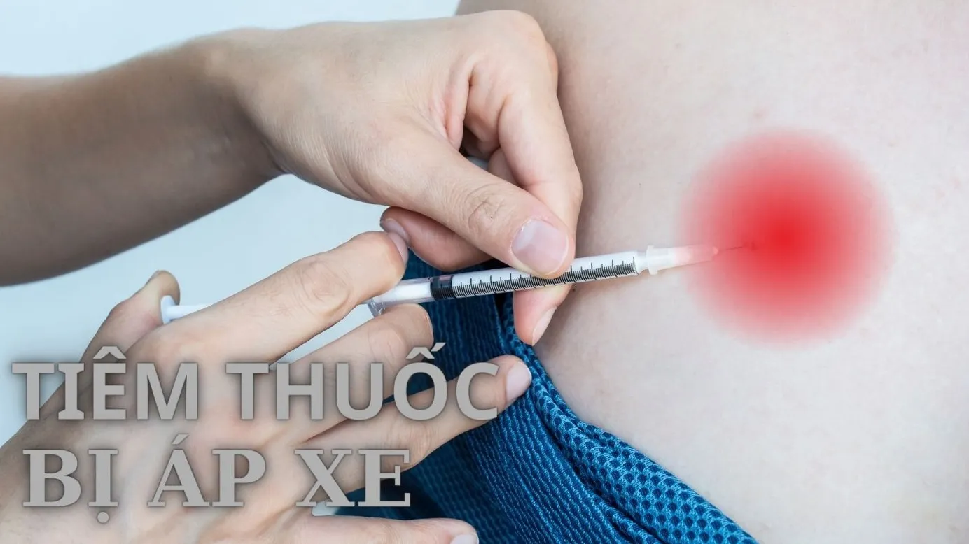 Sau khi tiêm thuốc bị áp xe phải làm sao? Biện pháp phòng ngừa áp xe sau tiêm