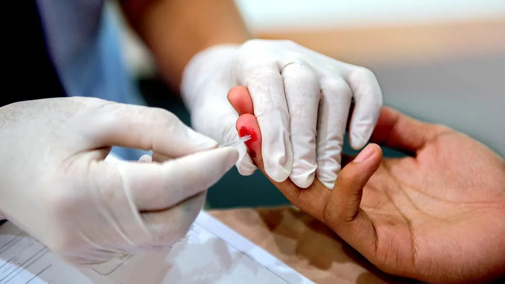 Tại sao xét nghiệm HIV phải làm 3 lần?