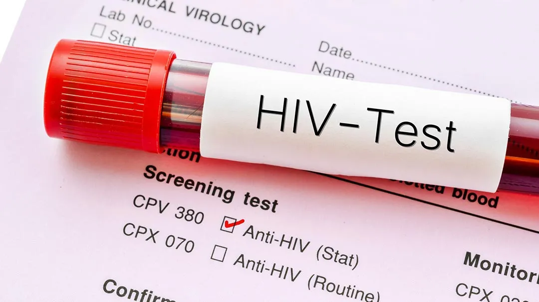 Thời gian xét nghiệm HIV cho kết quả chính xác nhất!