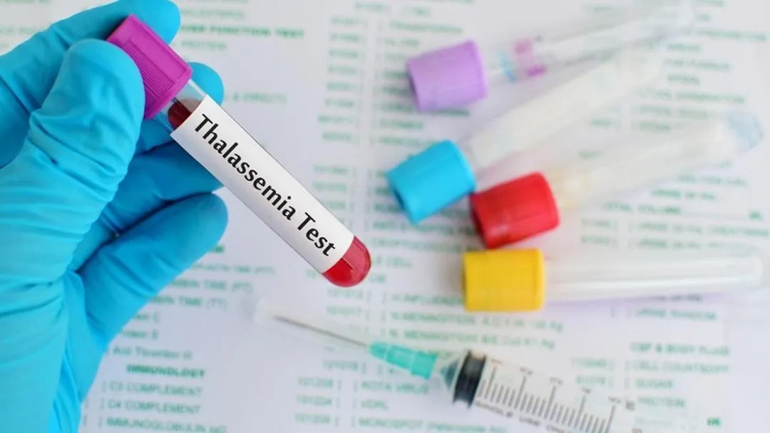 Xét nghiệm gen Thalassemia là gì? Những ai nên thực hiện xét nghiệm gen Thalassemia?