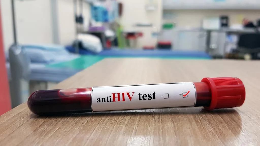 Xét nghiệm HIV 5 tháng âm tính đã an toàn chưa? Điều cần biết về HIV và xét nghiệm HIV