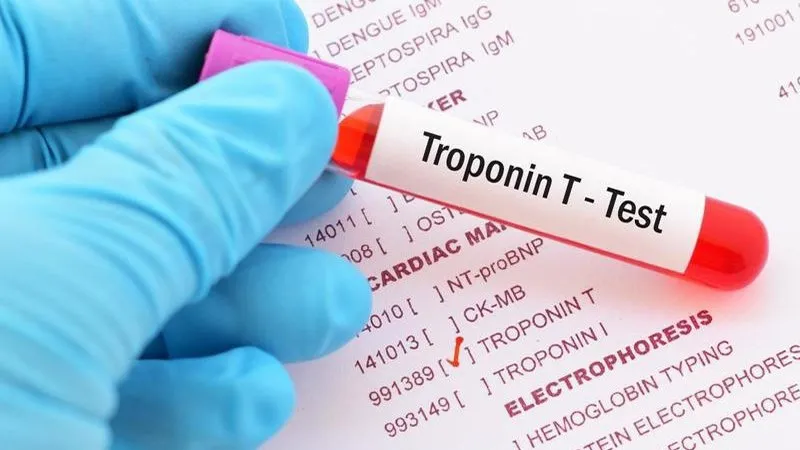 Xét nghiệm troponin T là gì? Ý nghĩa của xét nghiệm troponin T