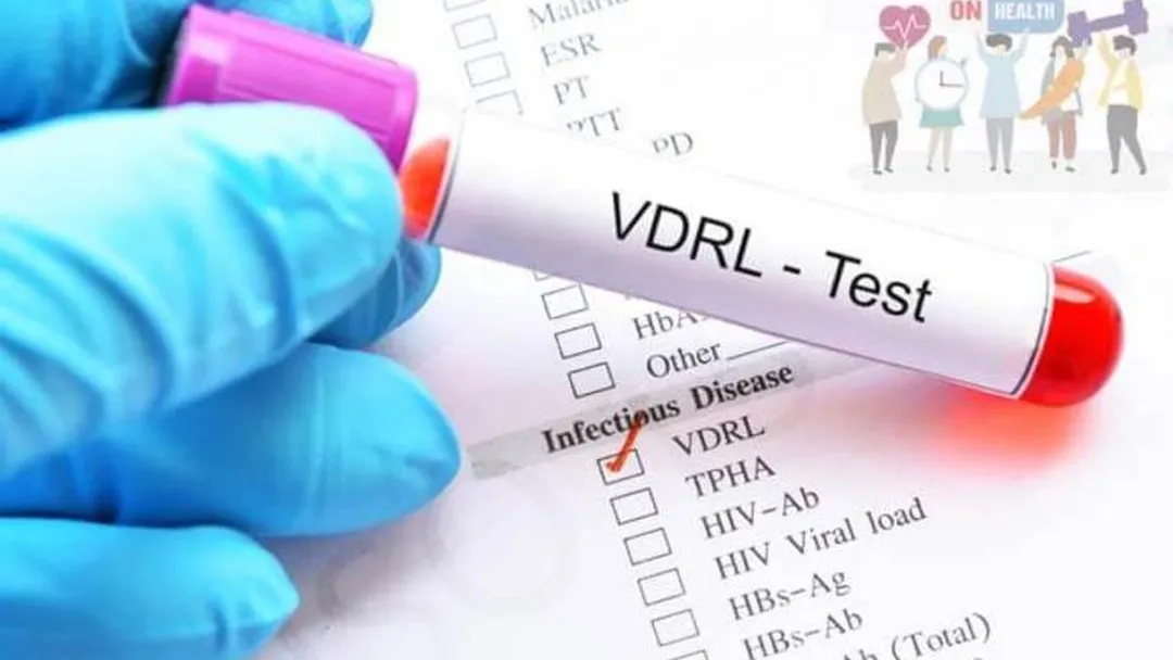 Xét nghiệm VDRL là gì? Tại sao cần làm xét nghiệm VDRL?