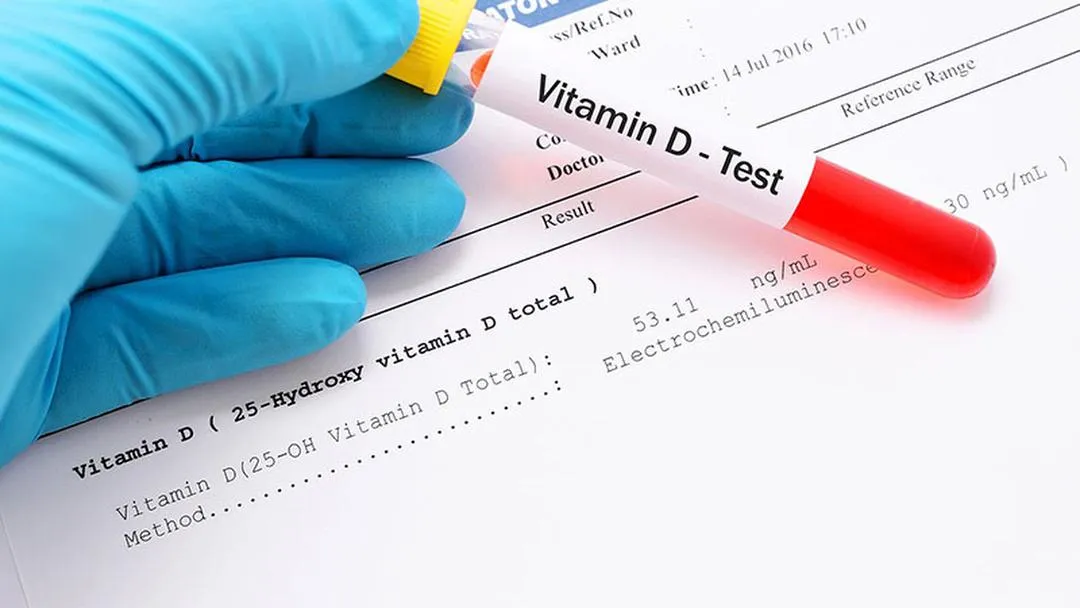 Ý nghĩa của xét nghiệm vitamin D là gì? Vai trò của vitamin D đối với cơ thể