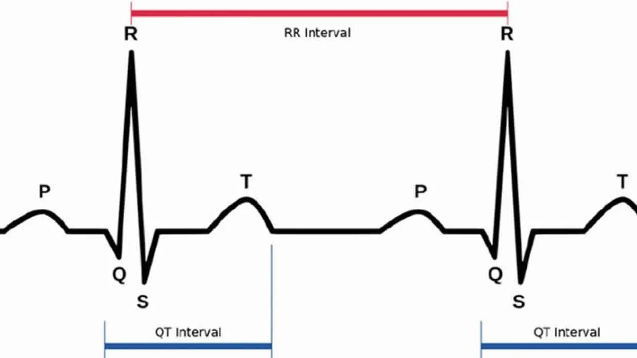 Hội chứng khoảng QT dài là gì? Nguyên nhân nào gây ra hội chứng khoảng QT dài?