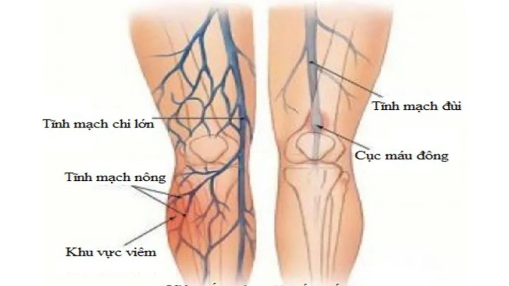 Tĩnh mạch đùi: Vị trí, chức năng và ý nghĩa lâm sàng trong y học