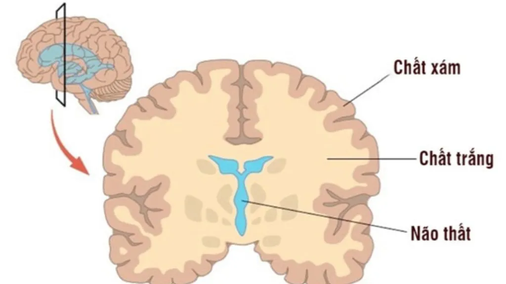 Tổn thương chất trắng não gây nguy hiểm không? Những điều bạn nên biết về căn bệnh